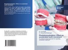 Bookcover of Photobiomodulation: Effect on accelerated tooth movement