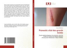 Couverture de Pronostic vital des grands brûlés