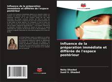 Buchcover von Influence de la préparation immédiate et différée de l'espace postérieur