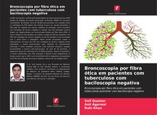 Copertina di Broncoscopia por fibra ótica em pacientes com tuberculose com baciloscopia negativa