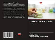 Обложка Prothèse partielle coulée