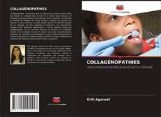 Bookcover of COLLAGÉNOPATHIES
