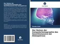 Couverture de Der Nutzen der Computertomographie des Gesichtsmassivs bei Osteopetrose