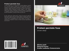Protesi parziale fusa的封面