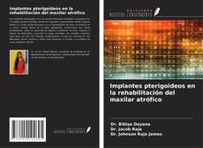 Implantes pterigoideos en la rehabilitación del maxilar atrófico kitap kapağı