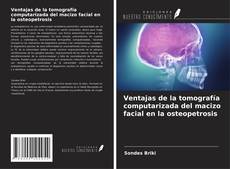 Portada del libro de Ventajas de la tomografía computarizada del macizo facial en la osteopetrosis