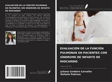 Bookcover of EVALUACIÓN DE LA FUNCIÓN PULMONAR EN PACIENTES CON SÍNDROME DE INFARTO DE MIOCARDIO