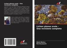 Lichen planus orale - Una revisione completa的封面
