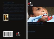 Copertina di COLLAGENOPATIE