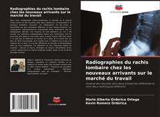 Borítókép a  Radiographies du rachis lombaire chez les nouveaux arrivants sur le marché du travail - hoz