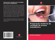 Copertina di Preparação moderna da cavidade de acesso endodôntico