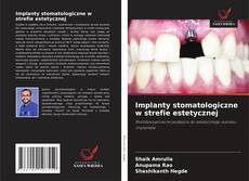 Copertina di Implanty stomatologiczne w strefie estetycznej