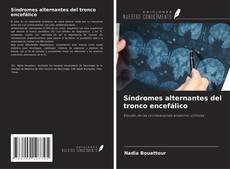 Síndromes alternantes del tronco encefálico kitap kapağı