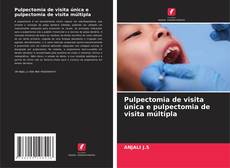 Capa do livro de Pulpectomia de visita única e pulpectomia de visita múltipla 