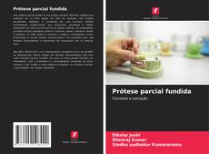 Copertina di Prótese parcial fundida