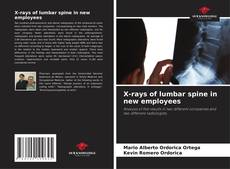 Portada del libro de X-rays of lumbar spine in new employees