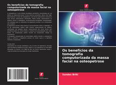 Copertina di Os benefícios da tomografia computorizada da massa facial na osteopetrose