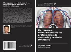 Marcapasos: conocimientos de los profesionales de anestesia y cuidados intensivos kitap kapağı