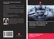 Bookcover of Doenças Fibro-Osseas do Esqueleto Craniofacial