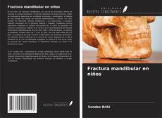 Copertina di Fractura mandibular en niños