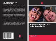Coroas anteriores em Odontopediatria的封面