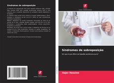 Bookcover of Síndromes de sobreposição