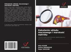 Copertina di Zakażenie układu moczowego i marskość wątroby