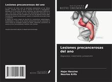 Lesiones precancerosas del ano kitap kapağı