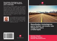 Borítókép a  Resultados histológicos para lesões cervicais não elegíveis para crioterapia - hoz
