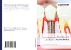 Buchcover von A handbook on PERI-IMPLANTITIS