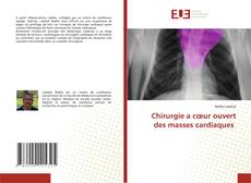 Couverture de Chirurgie a cœur ouvert des masses cardiaques