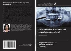 Enfermedades fibroóseas del esqueleto craneofacial的封面