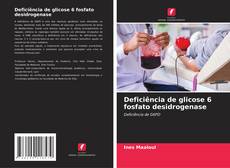 Copertina di Deficiência de glicose 6 fosfato desidrogenase