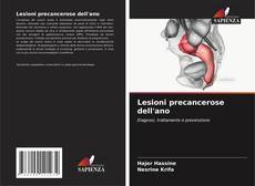 Couverture de Lesioni precancerose dell'ano