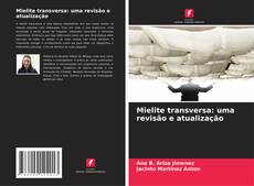 Bookcover of Mielite transversa: uma revisão e atualização
