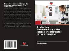 Buchcover von Évaluation morphométrique des lésions endométriales: revue exhaustive