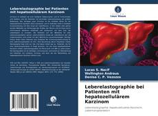 Bookcover of Leberelastographie bei Patienten mit hepatozellulärem Karzinom