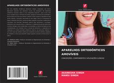 Capa do livro de APARELHOS ORTODÔNTICOS AMOVÍVEIS 