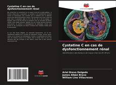 Bookcover of Cystatine C en cas de dysfonctionnement rénal