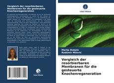 Vergleich der resorbierbaren Membranen für die gesteuerte Knochenregeneration的封面