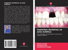Copertina di Implantes dentários na zona estética