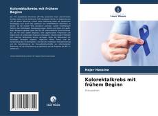 Kolorektalkrebs mit frühem Beginn的封面
