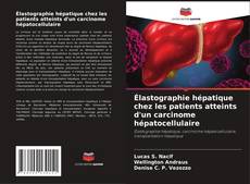 Élastographie hépatique chez les patients atteints d'un carcinome hépatocellulaire的封面