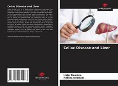 Copertina di Celiac Disease and Liver