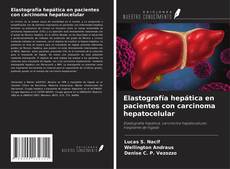 Copertina di Elastografía hepática en pacientes con carcinoma hepatocelular