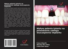 Обложка Wpływ palenia tytoniu na powodzenie zabiegu wszczepienia implantu