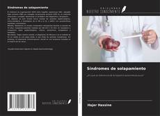 Copertina di Síndromes de solapamiento