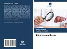 Zöliakie und Leber的封面