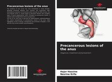 Precancerous lesions of the anus kitap kapağı