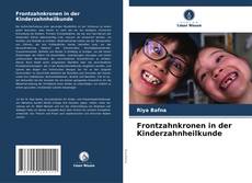 Couverture de Frontzahnkronen in der Kinderzahnheilkunde